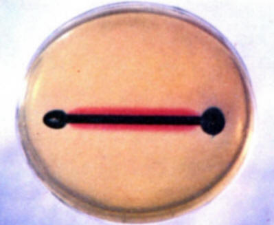  Note the development of blue and red colors at different places on the nail. 